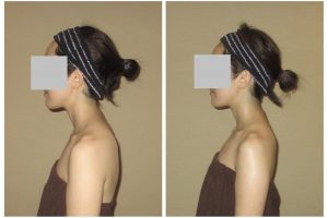 line_oa_chat_260217_141500