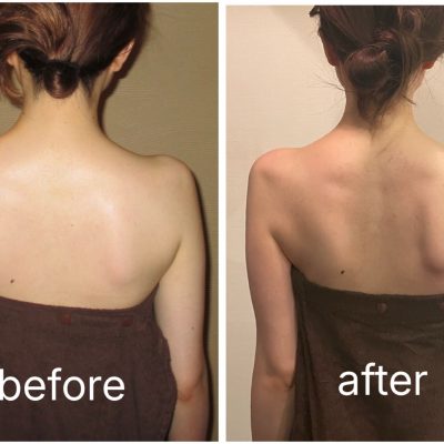 薄着の季節も骨格を整えればこわくない